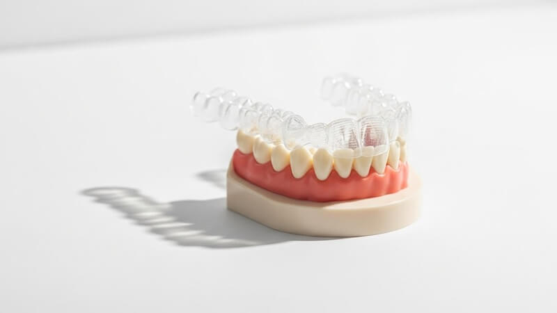 歯列矯正にはどんな種類がある?