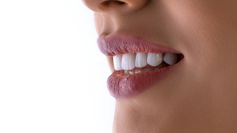 ガミースマイルとは?