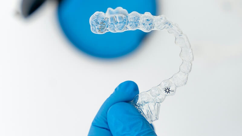 過蓋咬合の原因を解消する治療方法と選び方